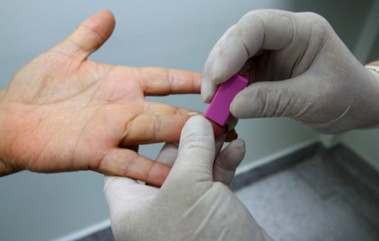 Julho Amarelo: Saúde promove exames rápidos para identificar hepatite,HIV e sífilis Julho Amarelo: Saúde promove exames rápidos para identificar hepatite,HIV e sífilis